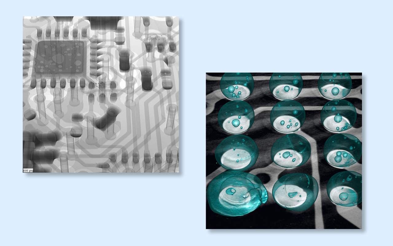 4. 2D- oder 3D-CT-R&ouml;ntgen: Welches ben&ouml;tigen Sie wirklich?